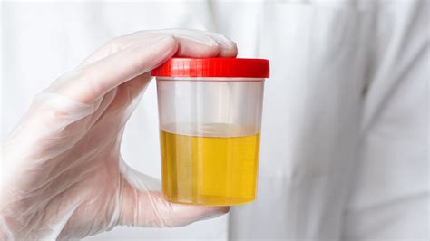 torn seal on urinalysis test vial|dot urine sample collection errors.